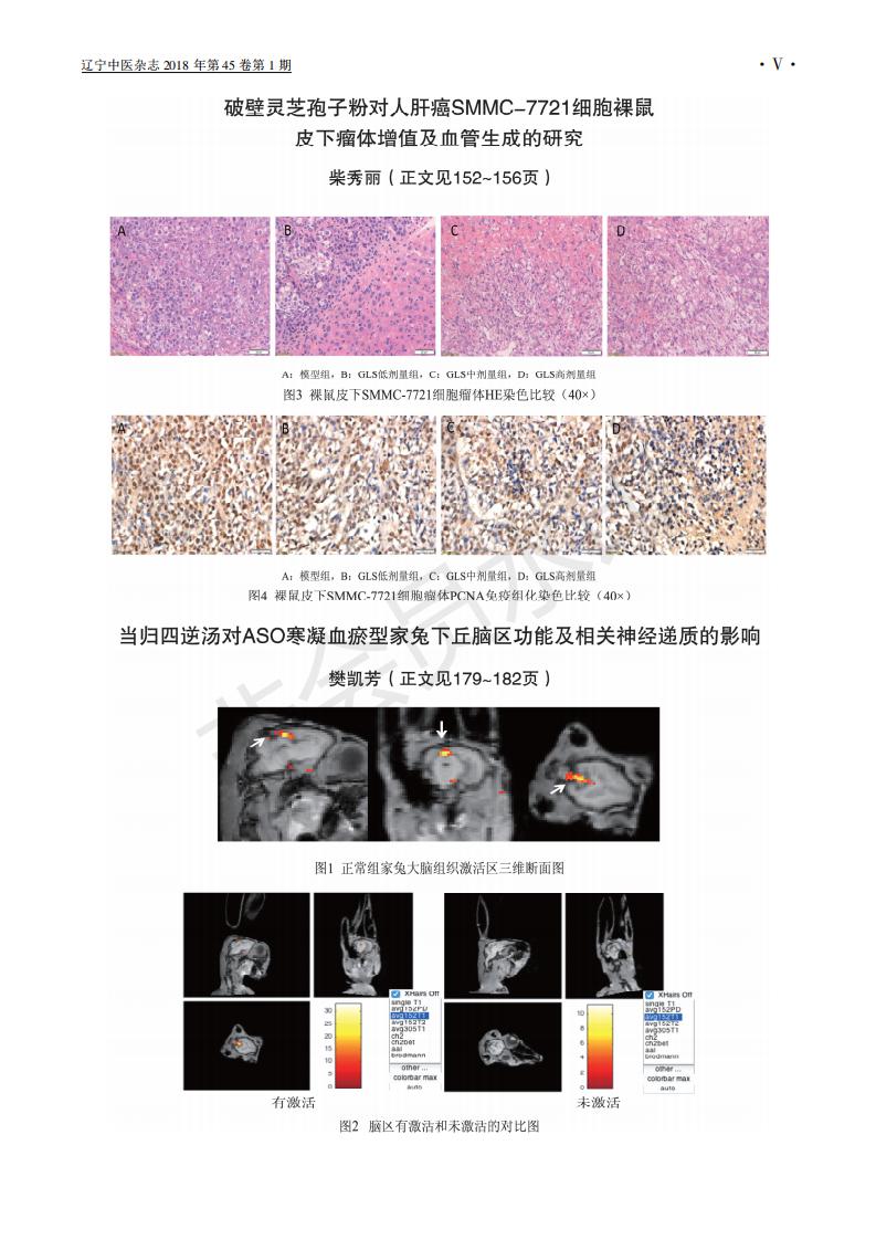 243 破壁灵芝孢子粉对人肝癌SMMC-7721细胞裸鼠皮下瘤体增殖及血管生成的研究_04.jpg