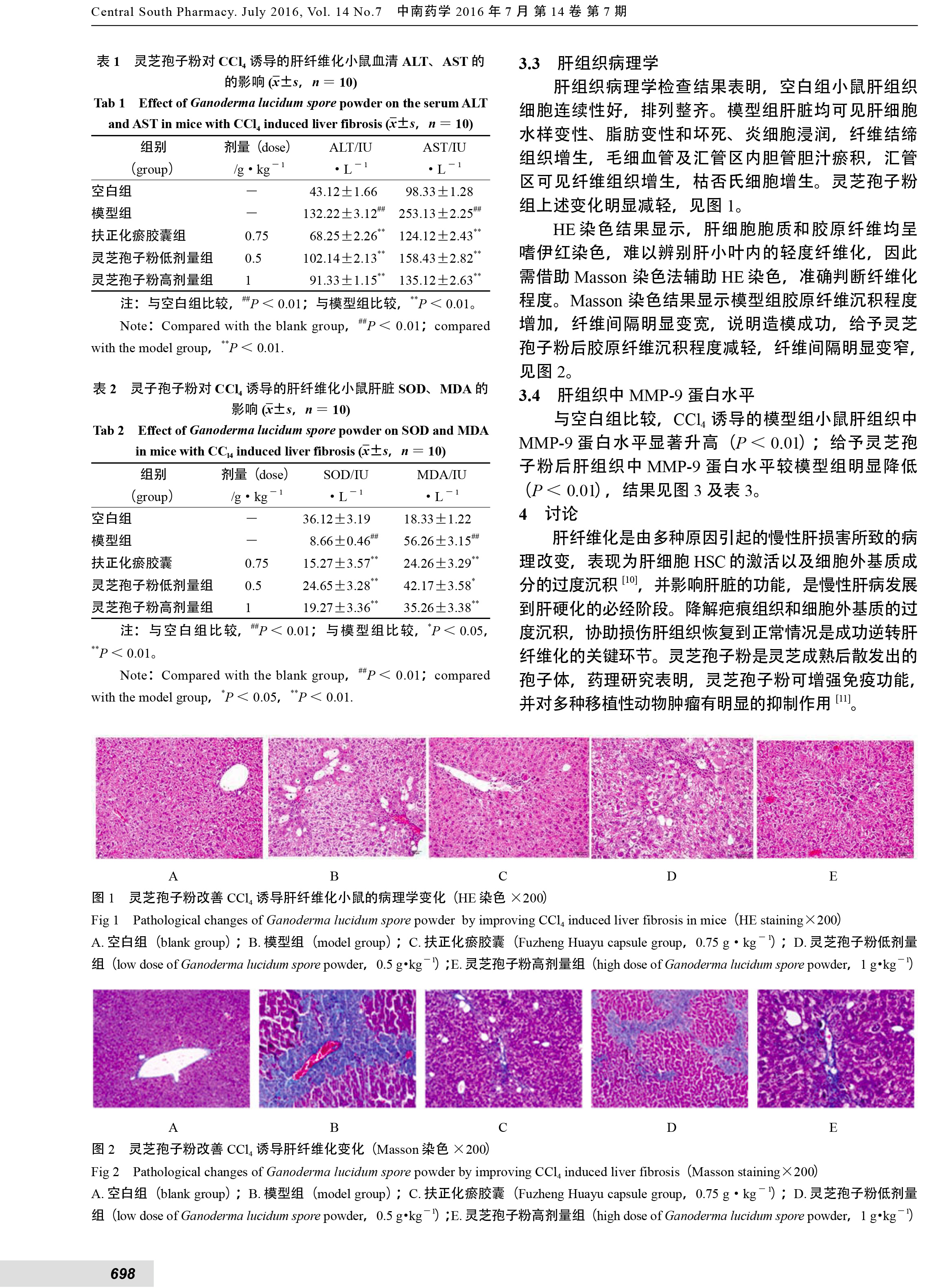 221 灵芝孢子粉保护CCl_4引起的小鼠肝纤维化损伤的实验研究-3.jpg